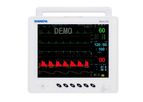 Shinova - Model Moni 8X - Multi-Parameter Veterinary Monitor