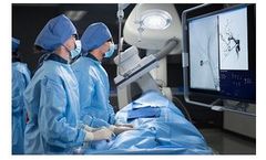Terumo - Groundbreaking Devices for Neurovascular Treatment