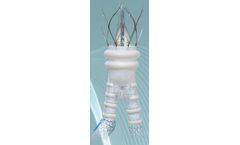 Endologix ALTO - Abdominal Stent Graft System