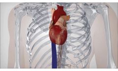 Sapien XT Pulmonic Procedural Animation - Video