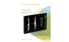 Smith-Nephew - Model RI.KNEE - Navigation System - Brochure