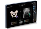 Smith-Nephew - Model RI.KNEE - Real Intelligence Knee Navigation System