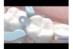 Palodent V3 I Dentsply Sirona - Video