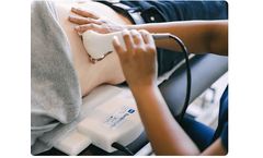 Velacur - Portable Handheld Ultrasound Technology