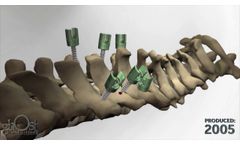 SeaSpine Sierra - Video