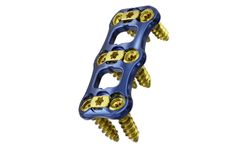 Admiral - Model ACP - Anterior Cervical Plating System
