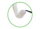 Axogen - Avance Nerve Graft