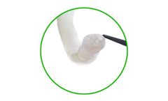 Axogen - Avance Nerve Graft