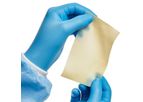 DuraSure - Biologic Patch