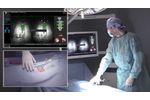 7D Surgical System – Spinal Workflow Demonstration - Video