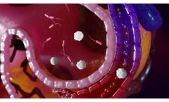 Inflammatix InSep Overview - Video