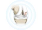 Hyalex - Human Cartilage Restoring