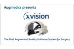 Xvision Introduction - Video