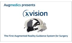 Xvision Introduction - Video