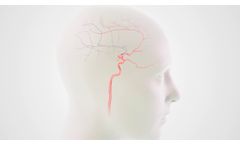 Zoom Stroke Solution Animation - Video