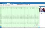 Zeto software demo for reading EEG - Video