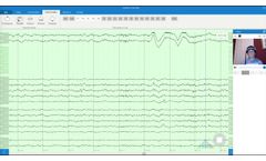 Zeto Software Demo for Reading EEG - Video