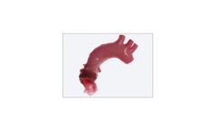 CryoValve - Aortic Valve Allograft