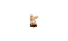 CryoValve - Model SG - Pulmonary Cryopreserved Human Tissue Heart Valve