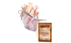 CryoPatch - Autologous Pericardium