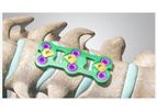 Cetra - Anterior Cervical Plate System
