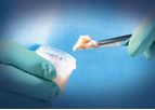 Trinity Evolution - Allograft with Viable Cells