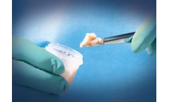 Trinity Evolution - Allograft with Viable Cells