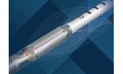 SmartAssist - Heart Pumps Technology