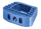 Hedron - Model ACDF -C - 3D Printed Anterior Cervical Interbody Fusion Spacer