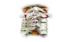 Relieve - Laminoplasty Plate