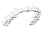 Align - Invisalign System