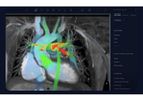 Arterys- - Version Cardio AI - Assisted Cardiac MRI Software