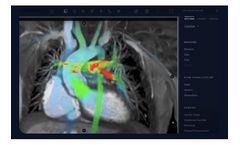 Arterys- - Version Cardio AI - Assisted Cardiac MRI Software