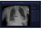 Arterys - Version | MSK AI - Emergency Department Chest X-ray Software