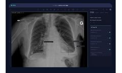 Arterys - Version | MSK AI - Emergency Department Chest X-ray Software