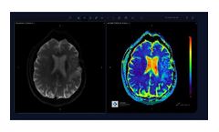 Arterys - Version Neuro AI - Neuro-Radiology Software