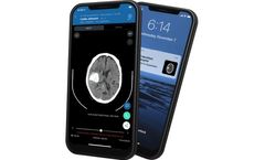 A.I. Viz ICH - Automated Detection and Triage of Suspected ICH