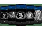Version Viz Aortic - AI-Powered Aortic Disease Detection