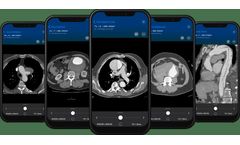 Version Viz Aortic - AI-Powered Aortic Disease Detection