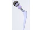 Conformis - Hip Replacement System