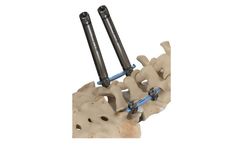 ATEC Invictus - Comprehensive Spinal Fixation Platform System