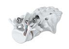 ATEC Arsenal - Cortical Bone Fixation System