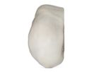 Advertising - Fresh-Stored Osteochondral Grafts