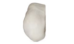 Advertising - Fresh-Stored Osteochondral Grafts