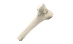 RTI - Structural Allografts