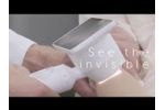 Barco Demetra: a smarter way of doing skin exams - Video