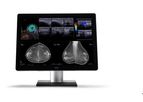 Coronis Uniti - Model MDMC-12133 - Radiology Display