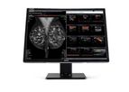 Nio Fusion - Model 12MP MDNC-12130 - Radiology Display