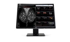 Nio Fusion - Model 12MP MDNC-12130 - Radiology Display