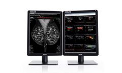 Barco - Model 5MP (MDNC-6121) - Nio Color Mammography Display